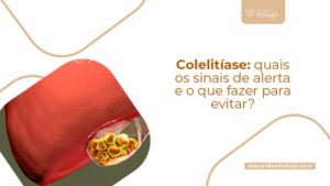 Colelitíase: quais os sinais de alerta e o que fazer para evitar? - Dr ...