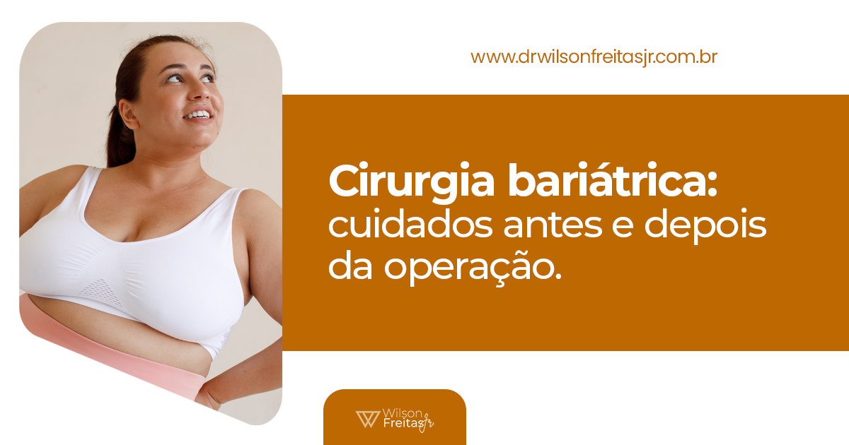 Cirurgia bariátrica: cuidados antes e depois da operação - Dr Wilson de ...