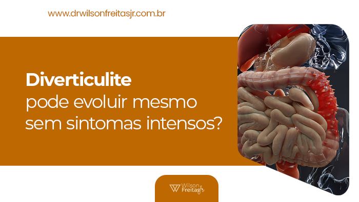 Ilustração anatômica do sistema digestivo com destaque em vermelho no intestino, representando diverticulite intestinal.